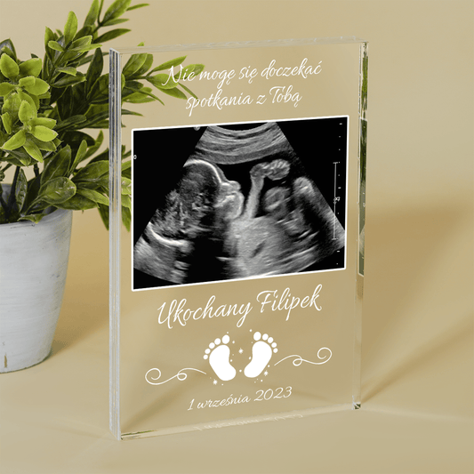 Pamiątkowe USG - Druk na szkle, spersonalizowany prezent dla dziecka - Adamell.pl