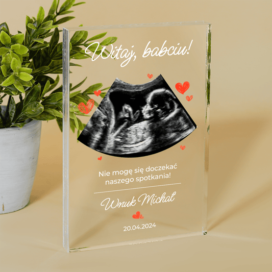 Zdjęcie USG wnuka - Druk na szkle, spersonalizowany prezent dla babci - Adamell.pl